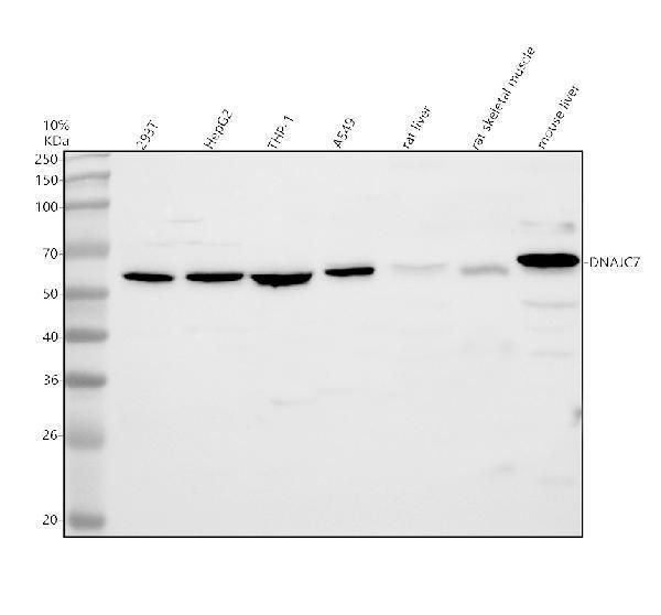 Western blot analysis of DNAJC7 using anti-DNAJC7 antibody (A07996-1)