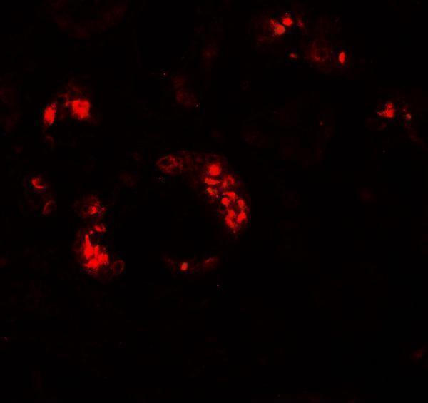 a07999 1 kank2 primary antibodies if testing 3