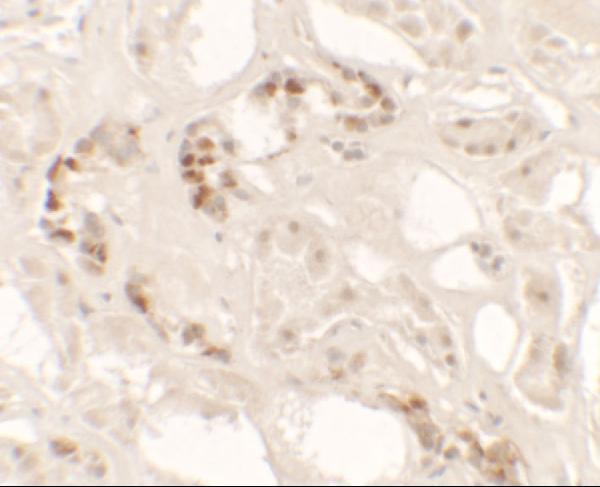 a07999 1 kank2 primary antibodies ihc testing 2