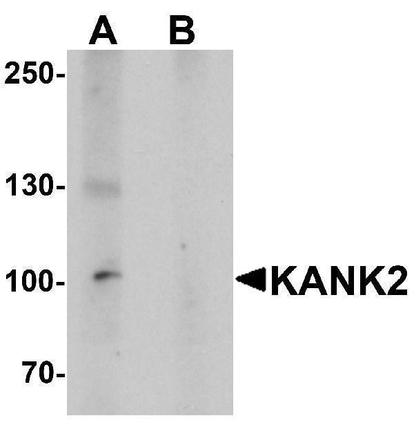 a07999 1 kank2 primary antibodies wb testing 1