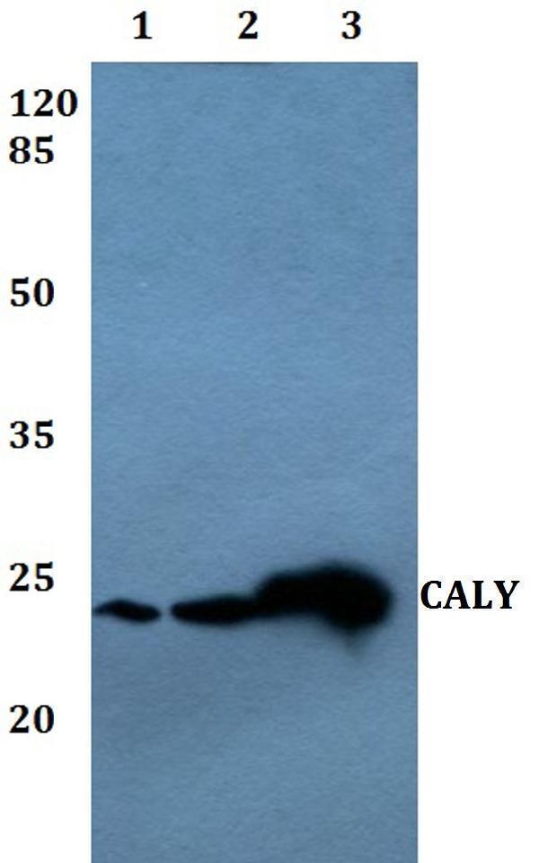 a08000 caly primary antiboties wb testing 1