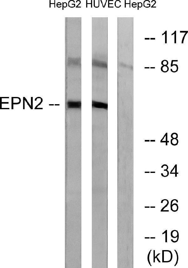 Western blot analysis of lysates from HepG2 and HUVEC cells, using EPN2 Antibody
