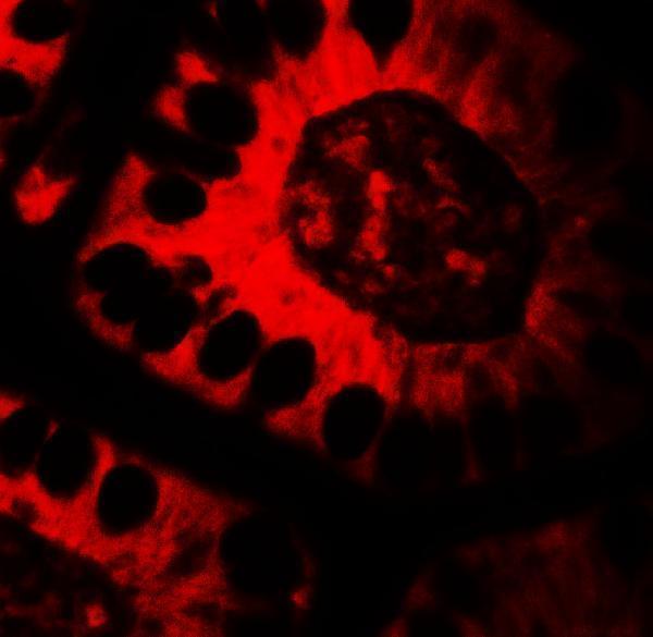 a08002 ticrr primary antibodies if testing 3