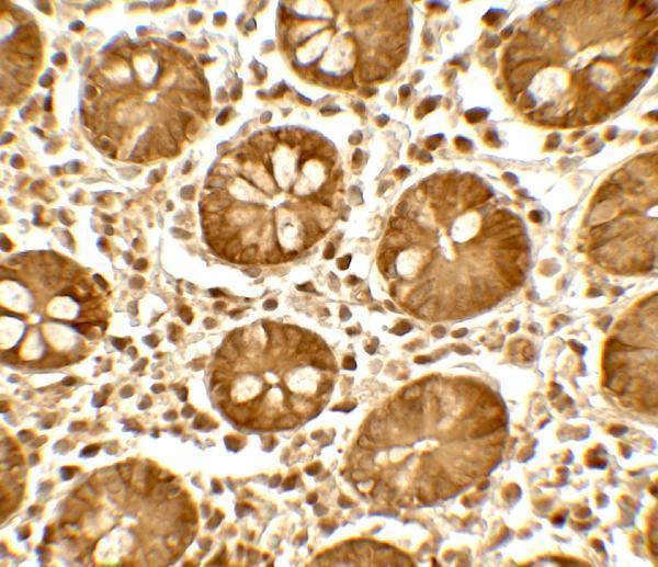 a08002 ticrr primary antibodies ihc testing 2