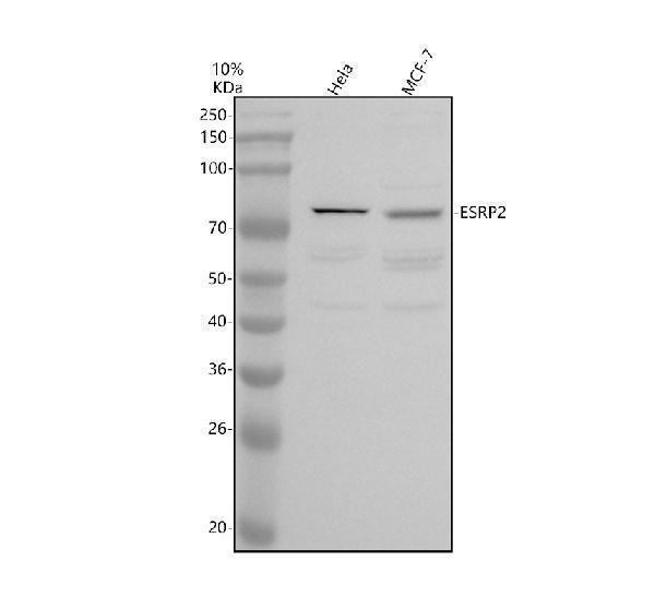 Western blot analysis of ESRP2 using anti-ESRP2 antibody (A08004-1)