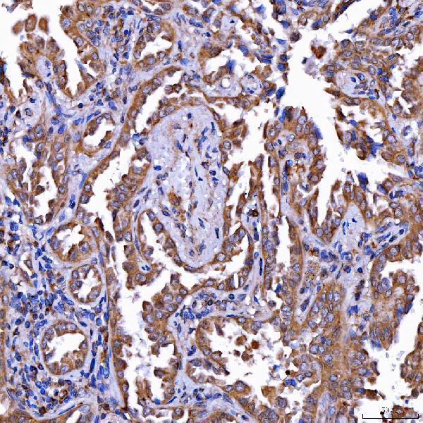  IHC analysis of LIN41/TRIM71 using anti-LIN41/TRIM71 antibody (A08005-2)