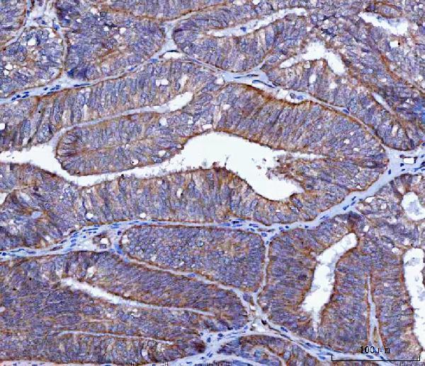  IHC analysis of LIN41/TRIM71 using anti-LIN41/TRIM71 antibody (A08005-2)