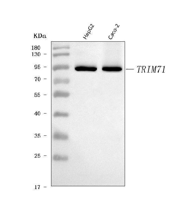  Western blot analysis of LIN41/TRIM71 using anti-LIN41/TRIM71 antibody (A08005-2)