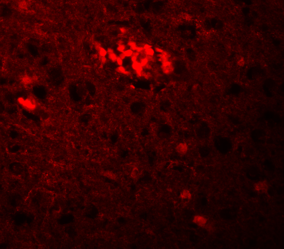 a08005 trim71 primary antibodies if testing 3