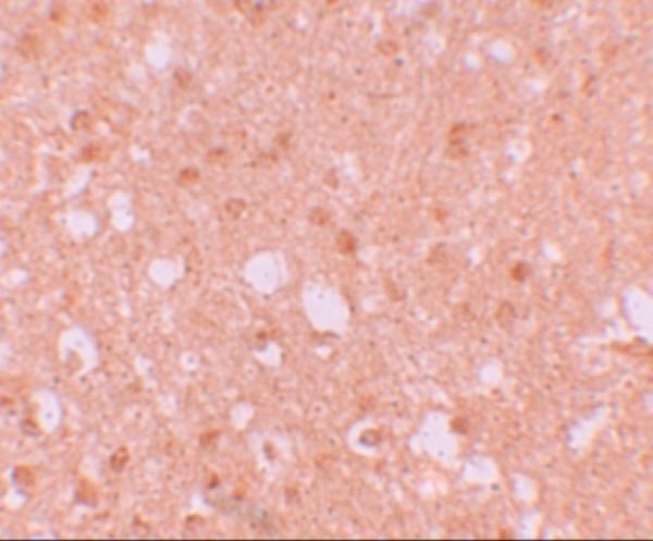 a08005 trim71 primary antibodies ihc testing 2