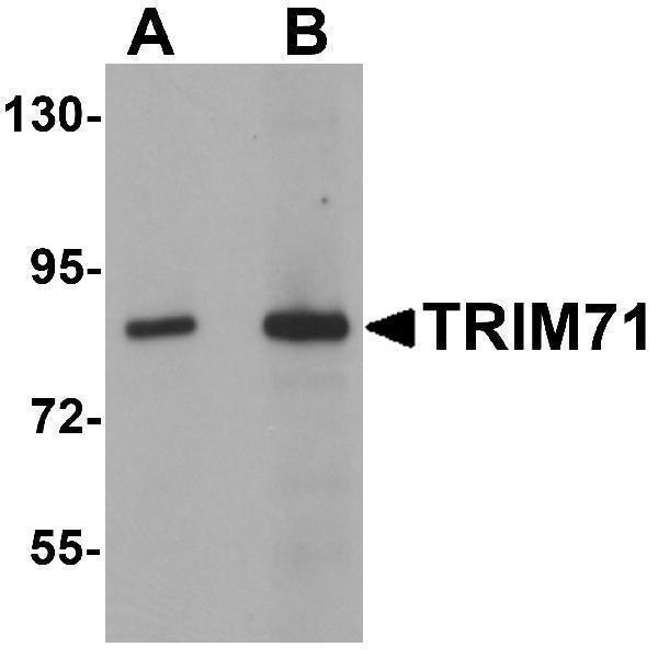 a08005 trim71 primary antibodies wb testing 1