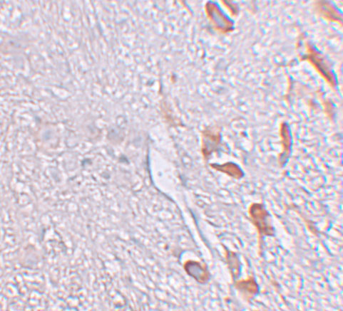 a08006 lrrtm1 primary antibodies ihc testing 2