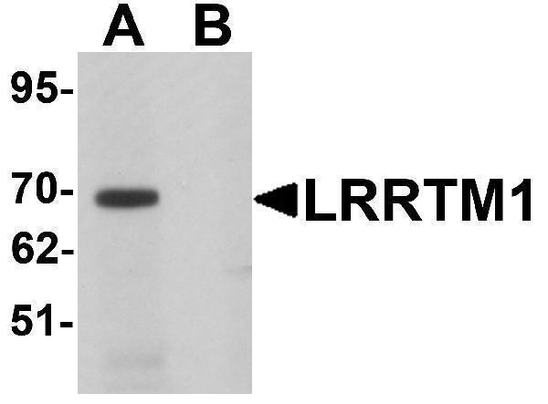 a08006 lrrtm1 primary antibodies wb testing 1