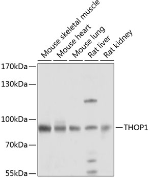 Western blot analysis of extracts of various cell lines, using THOP1 antibody  at 1:1000 dilution