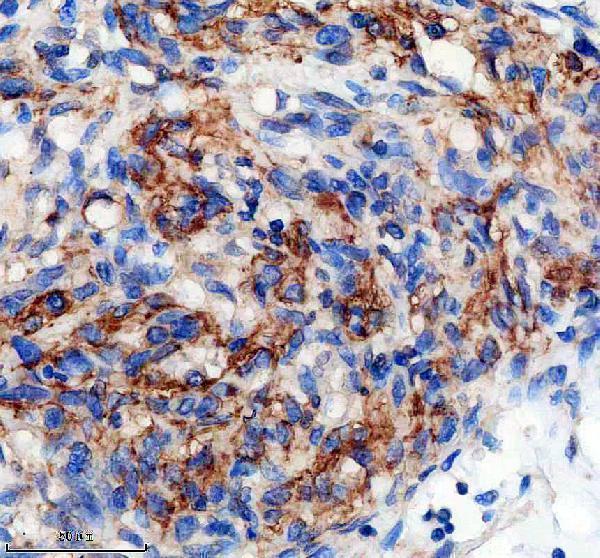 IHC analysis of PYGB using anti-PYGB antibody (A08012-1)