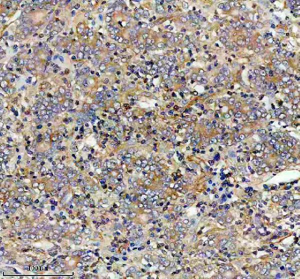 IHC analysis of PYGB using anti-PYGB antibody (A08012-1)