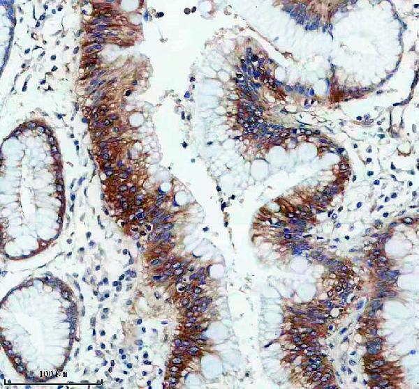 a08012 1 pygb primary antibodies ihc testing 3