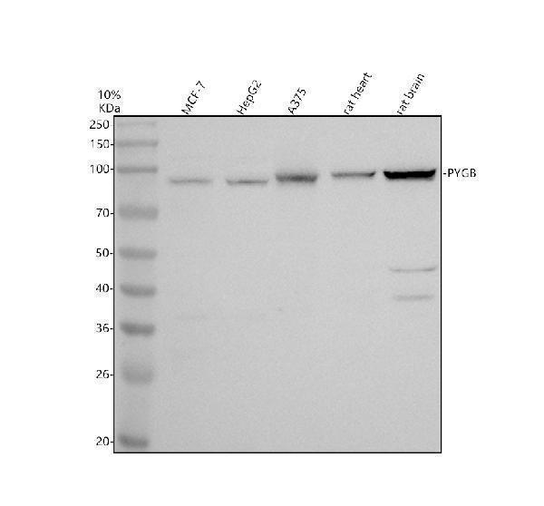 Western blot analysis of PYGB using anti-PYGB antibody (A08012-1)