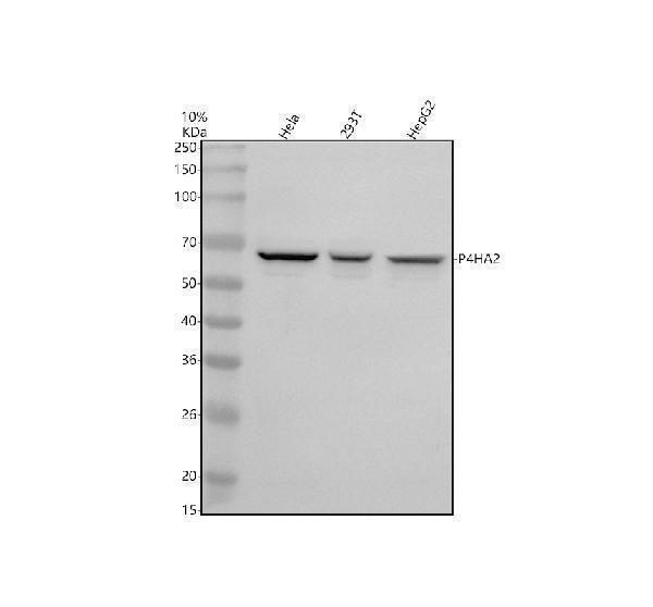 Western blot analysis of P4HA2 using anti-P4HA2 antibody (A08015-1)
