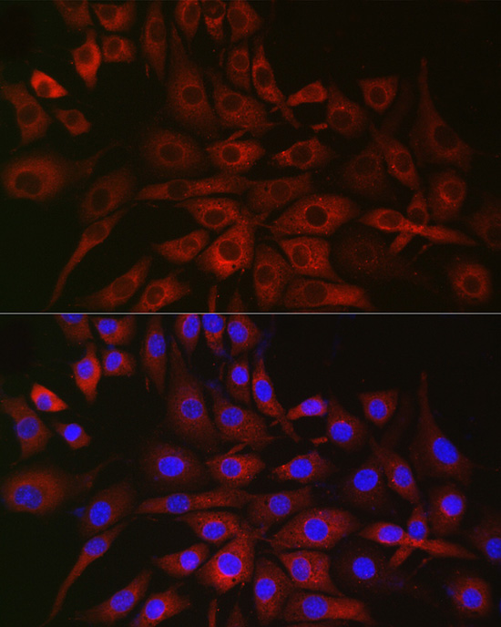 a08015 p4ha2 primary antiboties if testing 3