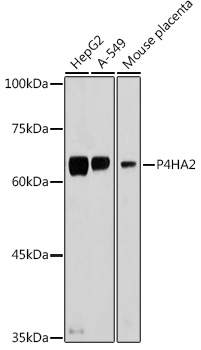 a08015 p4ha2 primary antiboties wb testing 1