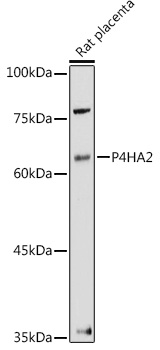 a08015 p4ha2 primary antiboties wb testing 2