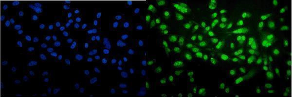  IF analysis of Cyclophilin E/PPIE using anti-Cyclophilin E/PPIE antibody (A08021-1)