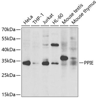 a08021 ppie primary antiboties wb testing 1