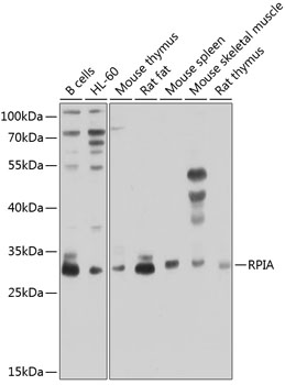 Western blot analysis of extracts of various cell lines, using RPIA antibody  at 1:1000 dilution