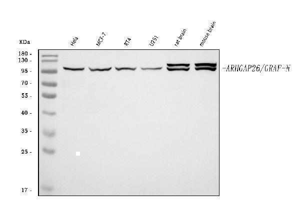  Western blot analysis of GRAF/ARHGAP26 using anti-GRAF/ARHGAP26 antibody (A08027-1)
