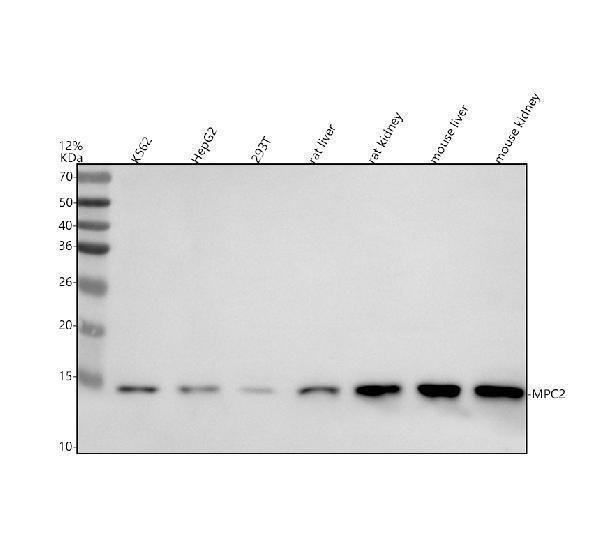 Western blot analysis of MPC2 using anti-MPC2 antibody (A08029-1)