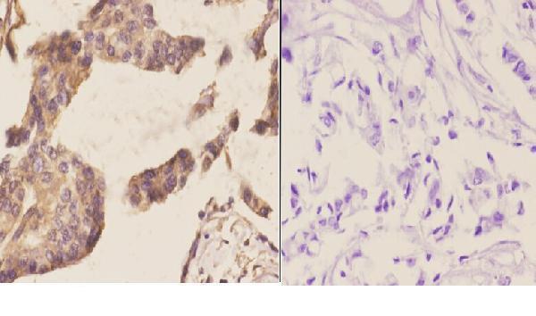 a08031 1 ncbp2 primary antiboties ihc testing 2