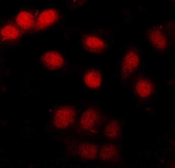a08031 2 ncbp2 primary antibodies if testing 4