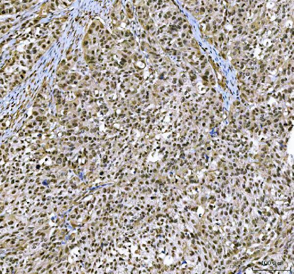  IHC analysis of CBP20/NCBP2 using anti-CBP20/NCBP2 antibody (A08031-2)