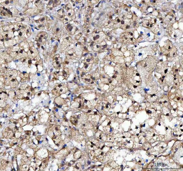  IHC analysis of CBP20/NCBP2 using anti-CBP20/NCBP2 antibody (A08031-2)
