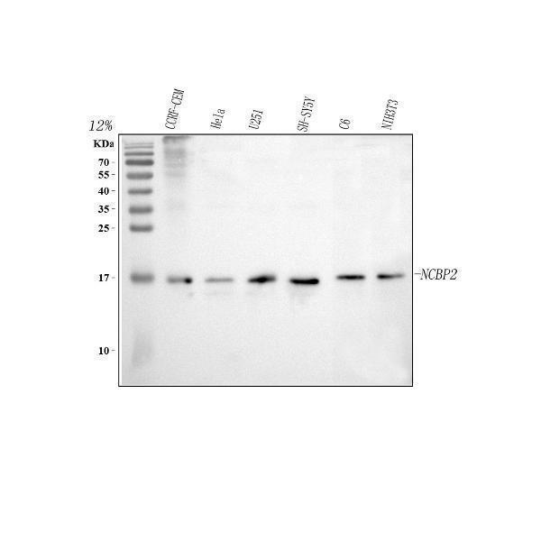  Western blot analysis of CBP20/NCBP2 using anti-CBP20/NCBP2 antibody (A08031-2)