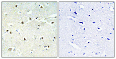 Immunohistochemistry validation of S100A16 using Anti-S-100A16 Antibody (A08032-1)