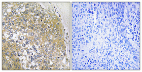Immunohistochemistry validation of S100A16 using Anti-S-100A16 Antibody (A08032-1)