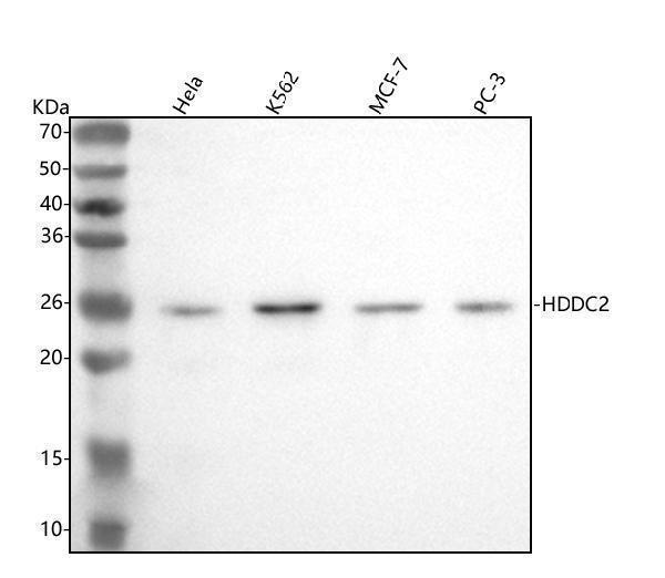  Western blot analysis of HDDC2 using anti-HDDC2 antibody (A08033-1)