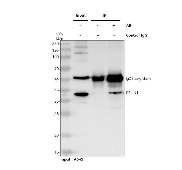 Immunoprecipitating ERLIN1 in A549 whole cell lysate