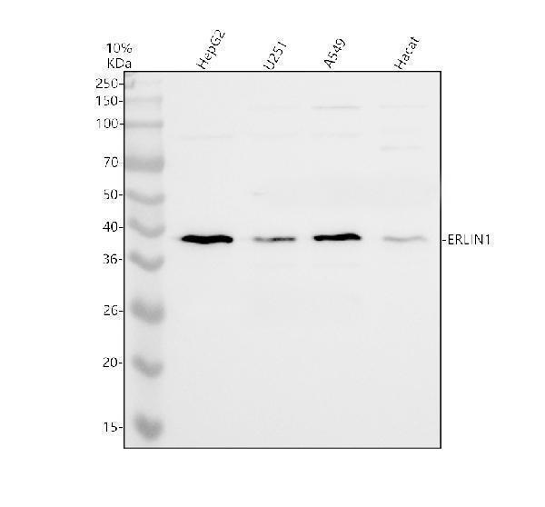 Western blot analysis of ERLIN1 using anti-ERLIN1 antibody (A08034-3)