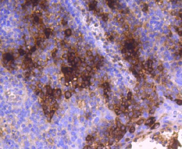 a08039 1 tpsab1 primary antiboties ihc testing 2