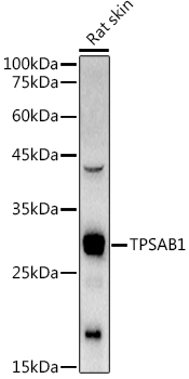 a08039 tpsab1 primary antiboties wb testing 1