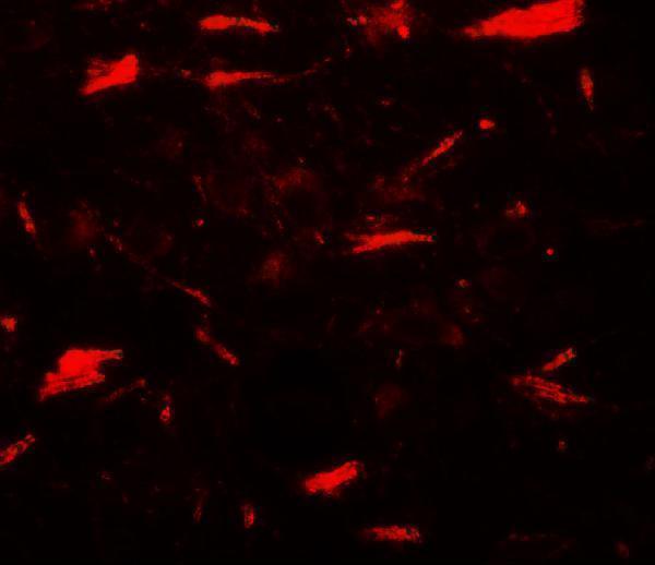 Immunofluorescence of LAMTOR3 in human brain tissue with LAMTOR3 antibody at 20 μg/mL