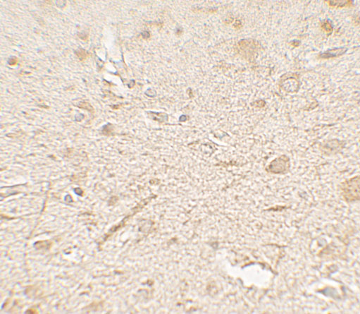 Immunohistochemistry of LAMTOR3 in human brain tissue with LAMTOR3 antibody at 5 μg/mL