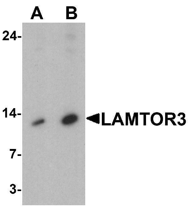 Western blot analysis of LAMTOR3 in human brain tissue lysate with LAMTOR3 antibody at (A) 1 and (B) 2 μg/ml