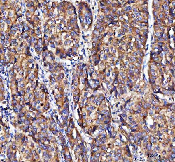  IHC analysis of MOAP1 using anti-MOAP1 antibody (A08043-1)