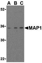 Western blot analysis of MAP-1 in EL4 cell lysate with MAP-1 antibody (IN) at (A) 1, (B) 2, and (C) 4 μg/mL