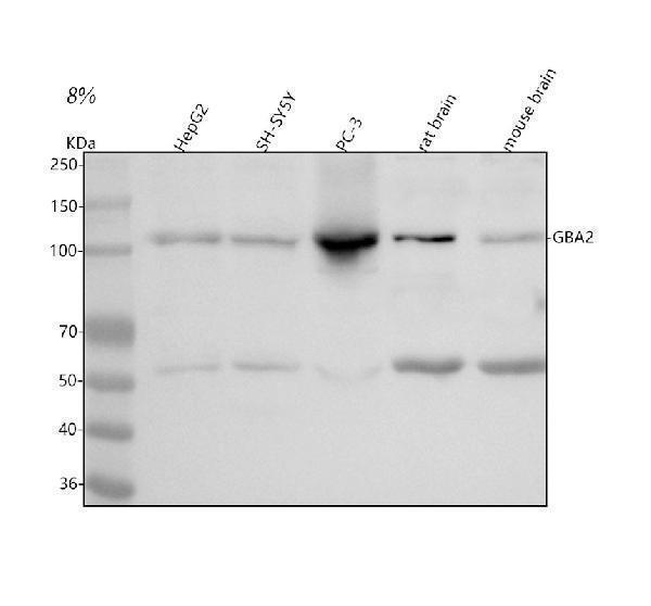  Western blot analysis of GBA2 using anti-GBA2 antibody (A08047-1)