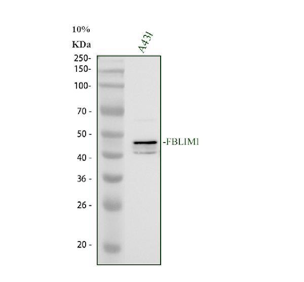 Western blot analysis of FBLIM1 using anti-FBLIM1 antibody (A08050-1)